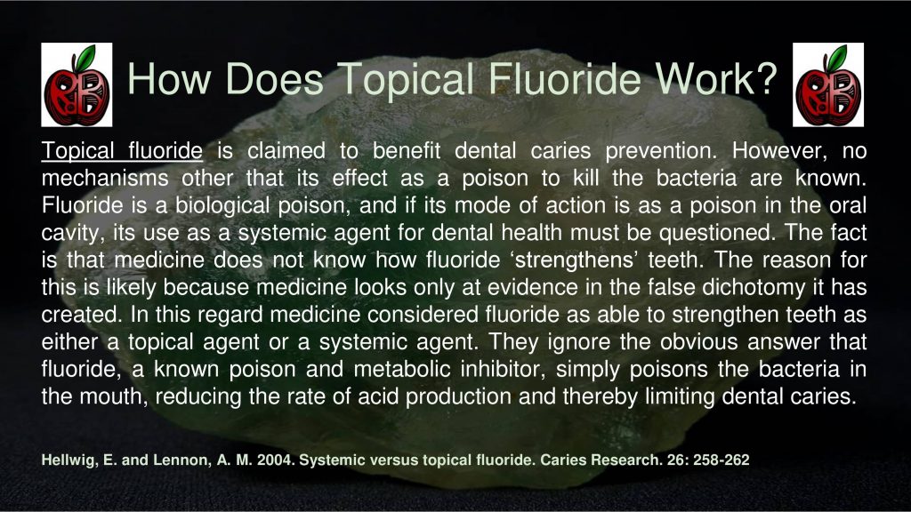 topical fluoride